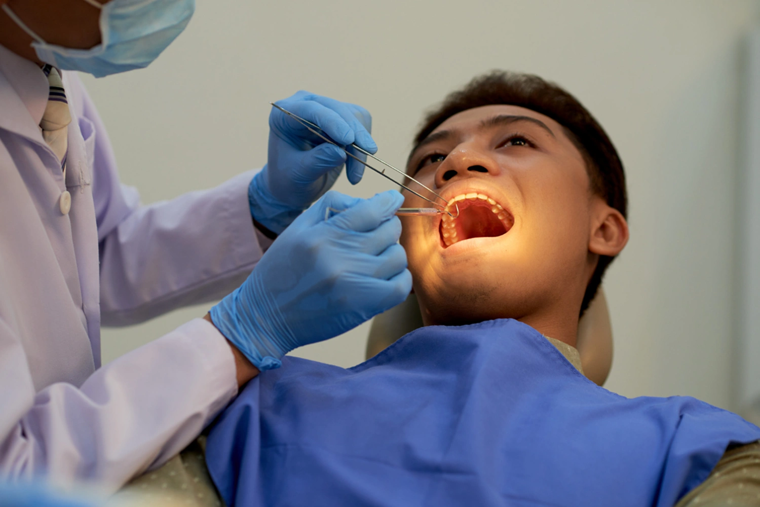Root Canal <br>Treatment